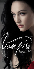 Vampire Facelift Victoria, TX